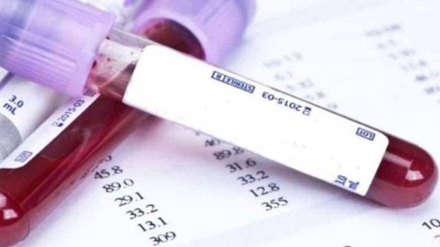 hemogram kan testleri